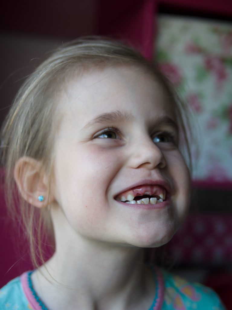 Hannah is drie melktanden op rij verloren 8-)